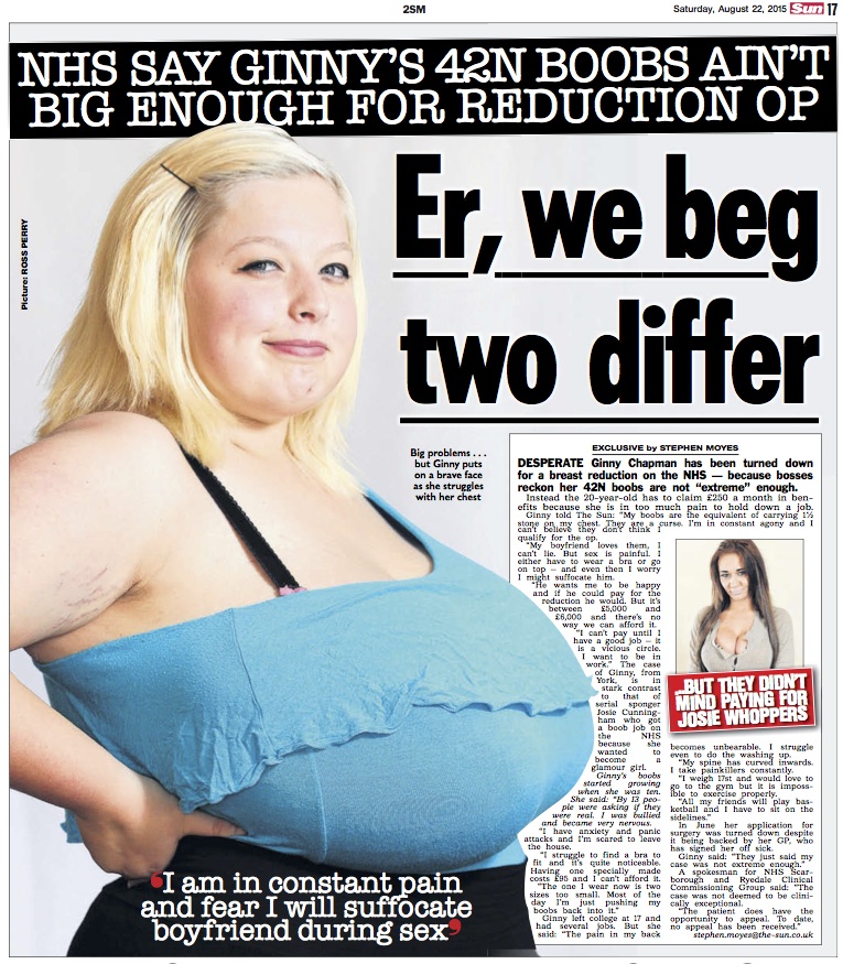 Gigantic boobs girl refused breast reduction on the NHS